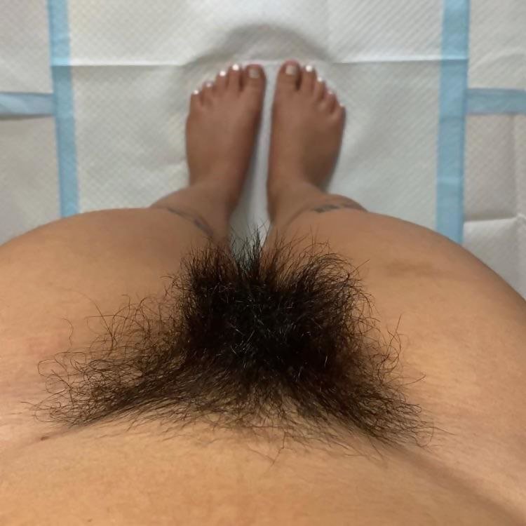 Hairy girl #SimMd8gI